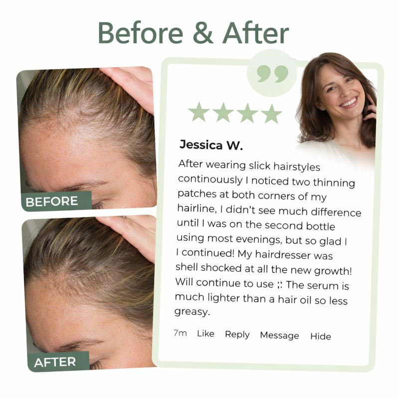 Peptide Hair Serum for Growth, Volume, & Thickness