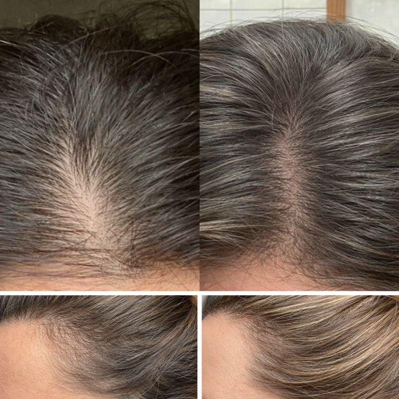 Peptide Hair Serum for Growth, Volume, & Thickness