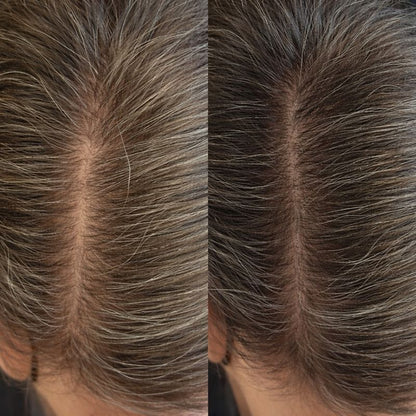 Peptide Hair Serum for Growth, Volume, & Thickness